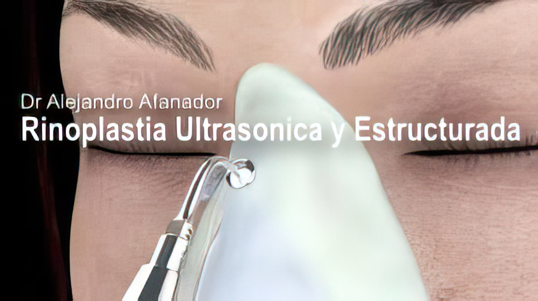 simulador-de-rinoplastia